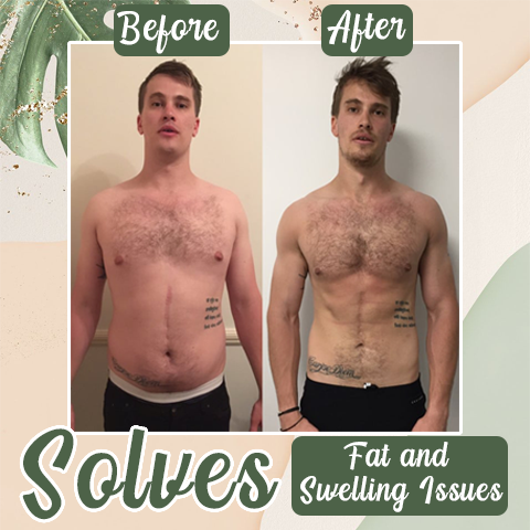 Perfekt Detox Bantningsplåster (Begränsad tidsrabatt 🔥 Sista dagen)