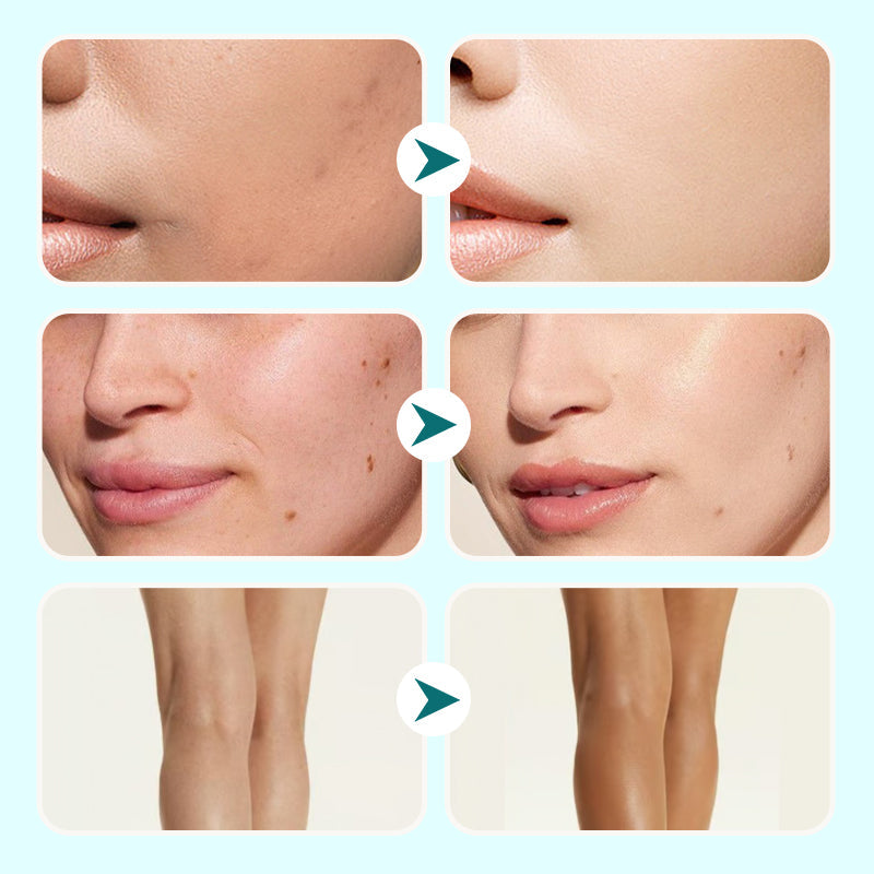 🔥 30% RABATT - Vattenfast & Återfuktande Concealer för Kvinnor